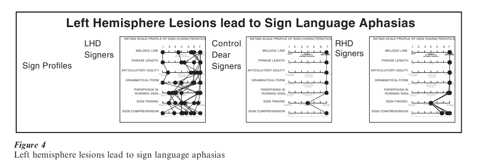 Sign Language Research Paper Figure 4