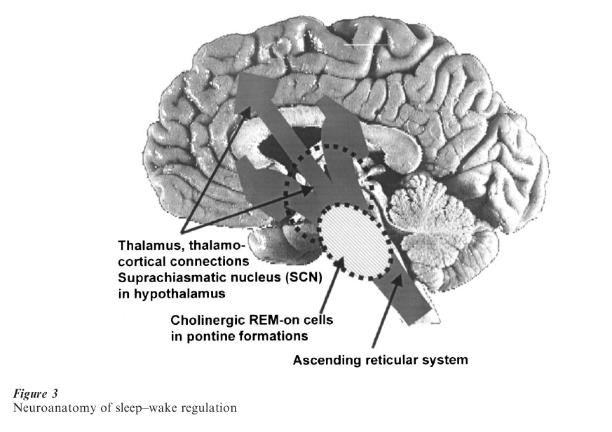Psychiatric Aspects of Sleep Disorders Research Paper Figure 3