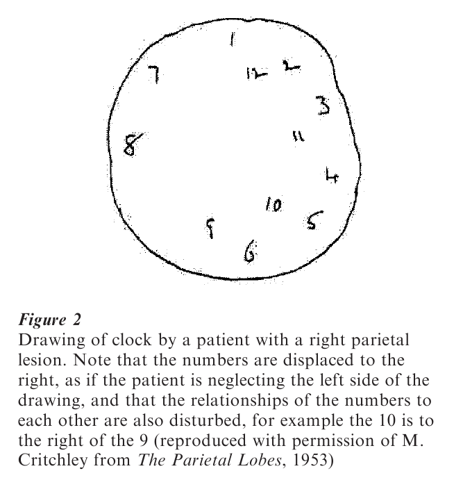 Parietal Lobe Research Paper Figure 2