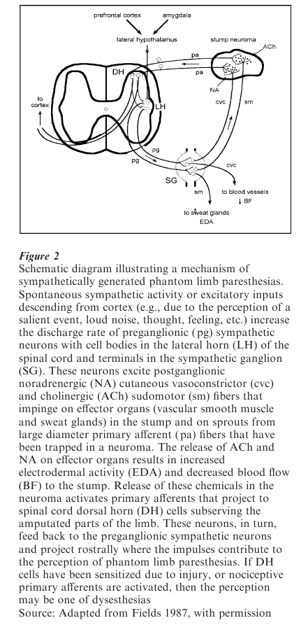 Phantom Limbs Research Paper Figure 2